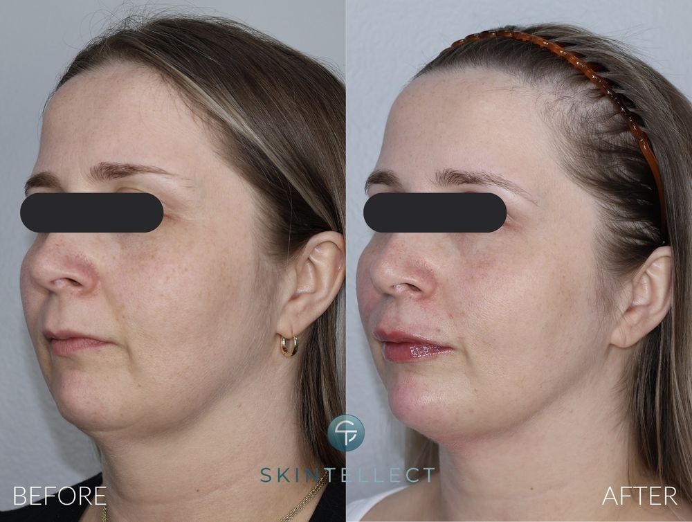 Skintellect Laser & Aesthetics Logo