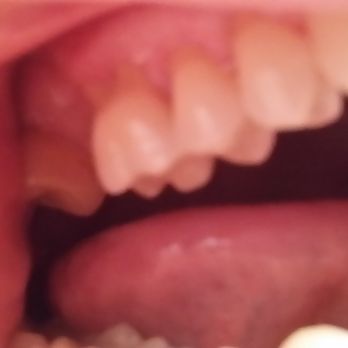 Island Vista Dental - General Dentistry Near Me - Oxnard, California Island Vista Dental - General Dentistry Near Me - Oxnard, California