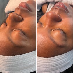 Total Bloom Skincare