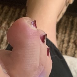 Red and swollen