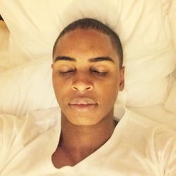 AYA - My face after the first SCITON  Laser peel.