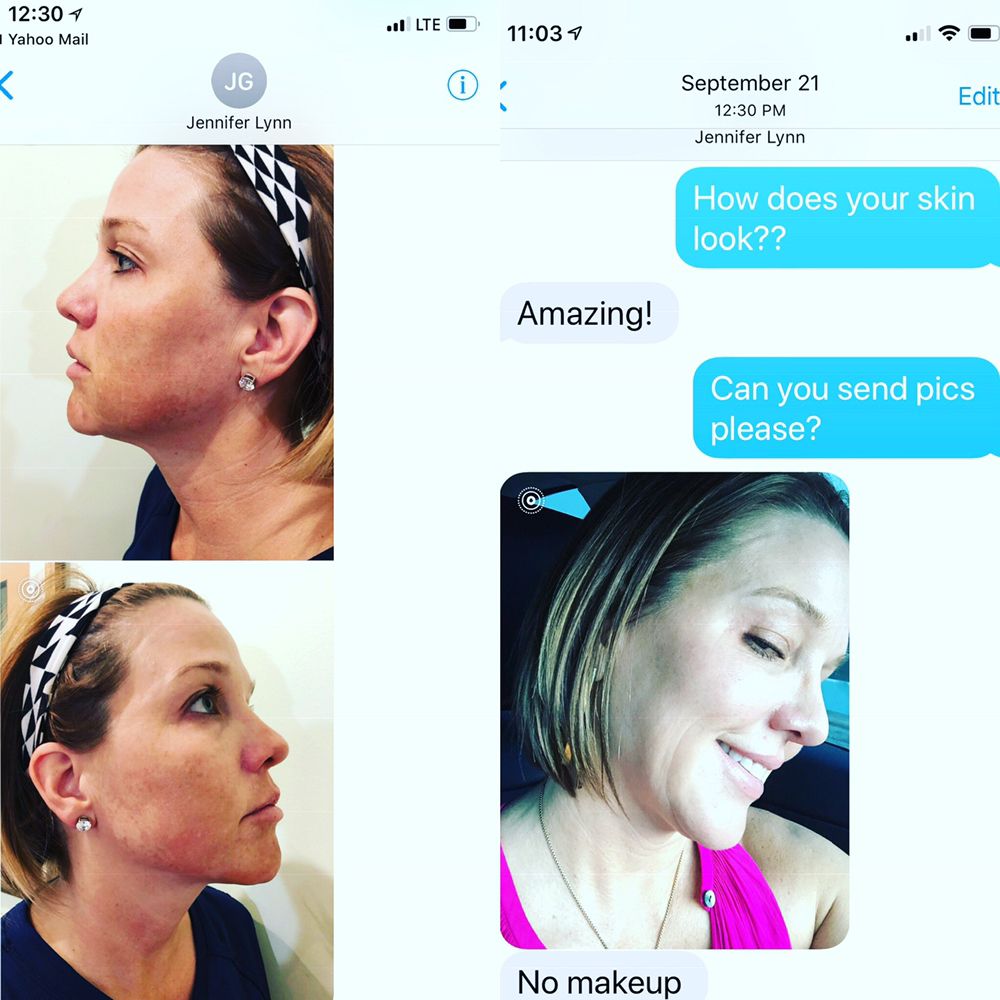 KAREN TAYLOR SKIN CARE & MEDICAL AESTHETICS - 17 Photos - Skin Care