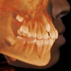 Bridgham Barr Orthodontics - 3D Technology