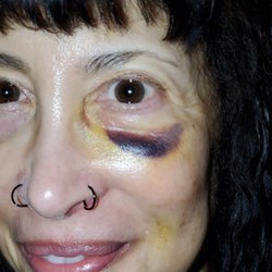 Robinson Facial Plastic Surgery