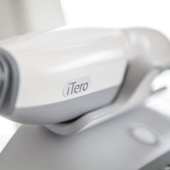 Belman Dental Centre - iTero 3-D Optical Scanner No more impressions - General Dentistry Near Me - Toronto, Ontario Belman Dental Centre - iTero 3-D Optical Scanner No more impressions - General Dentistry Near Me - Toronto, Ontario
