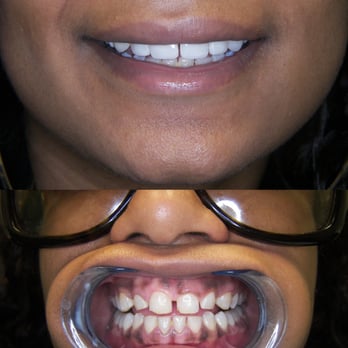 All About Beautiful Smiles - All About Beautiful Smiles - Cosmetic Dentists Near Me - Las Vegas, Nevada All About Beautiful Smiles - All About Beautiful Smiles - Cosmetic Dentists Near Me - Las Vegas, Nevada