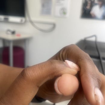 No Nail - This is taken less than 72 hours after my visit - Nail Salons Near Me - New York, New York No Nail - This is taken less than 72 hours after my visit - Nail Salons Near Me - New York, New York