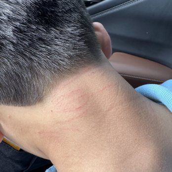 Kim For Hair - My 8-year-old son's neck after a haircut here...avoid this place at all costs. - Hair Salons Near Me - San Francisco, California Kim For Hair - My 8-year-old son's neck after a haircut here...avoid this place at all costs. - Hair Salons Near Me - San Francisco, California