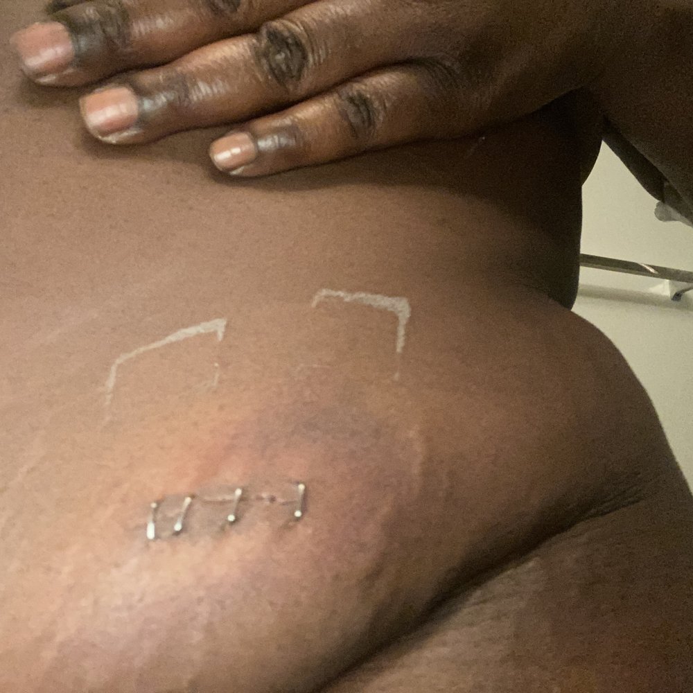 Around The Clock Tow - Almost cut my kidney - Roadside Assistance Near Me