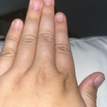 Hands To Hold - Aftermath of gel x being taken off - Nail Salons Near Me - Encino, California
