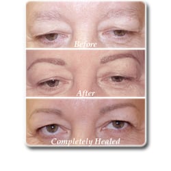 Skin Deep Permanent Cosmetics