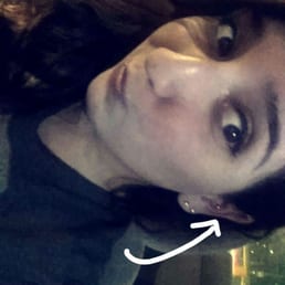 Occipital Conch Piercing done by Jen. (I paid $40) Occipital Conch Piercing done by Jen. (I paid $40)