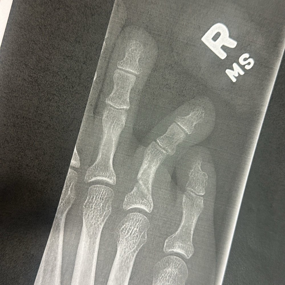Murrieta Express Care - The x-ray from the hospital, urgent care didn't provide anything. - Urgent Care Near Me - Murrieta, California Murrieta Express Care - The x-ray from the hospital, urgent care didn't provide anything. - Urgent Care Near Me - Murrieta, California