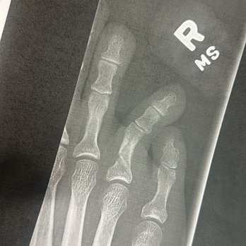 Murrieta Express Care - The x-ray from the hospital, urgent care didn't provide anything. - Urgent Care Near Me - Murrieta, California