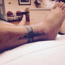 Jaivin S Jonathan, MD - Tib fib compound fracture