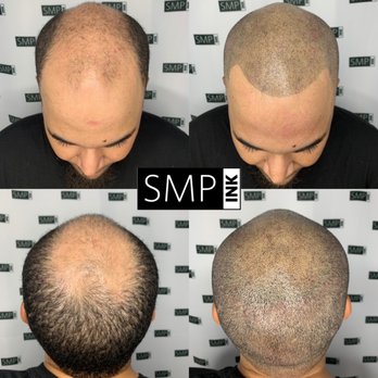 SMP Ink - Before and after - Permanent Makeup Near Me - Danville , California SMP Ink - Before and after - Permanent Makeup Near Me - Danville , California