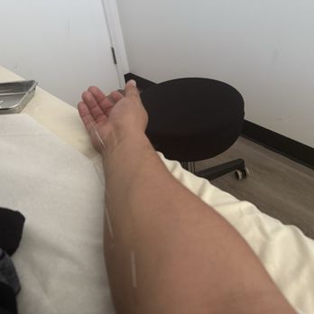 Northridge Acupuncture - Acupuncture Near Me - Reseda, California