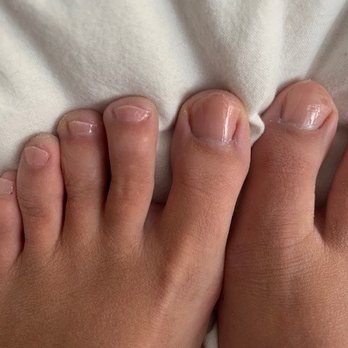 Snappy Nails & Spa - toenails cut so short + jagged - Nail Salons Near Me - Denver, Colorado