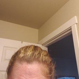 A few days after my appointment A few days after my appointment