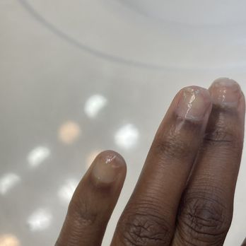 Oasis Nail Spa - Painful and torn nails - Nail Salons Near Me - Pearland, Texas Oasis Nail Spa - Painful and torn nails - Nail Salons Near Me - Pearland, Texas