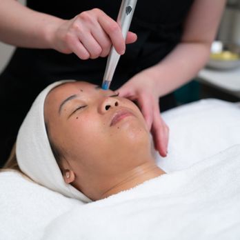 Total Skin Fitness - Rezenerate nanofacial - Skin Care Near Me - Poway, California Total Skin Fitness - Rezenerate nanofacial - Skin Care Near Me - Poway, California