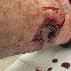 As I came in 4 hours after incident.
