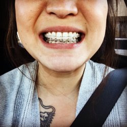 Parle Orthodontics - They're coming along, and they've made such an improvement already!