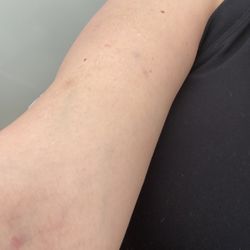 Restore Hyper Wellness - The only thing I left with was bruises..