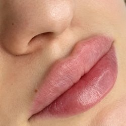 ReNuMe Med Spa - Your lips, with a little more to love. Explore personalized lip enhancement at ReNuMe. Book your free consultation.