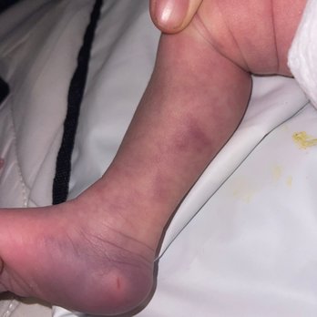 Agave Pediatrics - NURSE ABUSED MY BABY - Pediatricians Near Me - Goodyear, Arizona Agave Pediatrics - NURSE ABUSED MY BABY - Pediatricians Near Me - Goodyear, Arizona