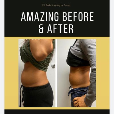 BODY SCULPTING & MASSAGE - Pain free, noninvasive targeted Fat removal with no downtime call to make an appointment! BODY SCULPTING & MASSAGE - Pain free, noninvasive targeted Fat removal with no downtime call to make an appointment!