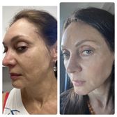 TOP 10 BEST Glutathione Injection in New York, NY - Updated 2026 - Quality  & Affordability - Yelp