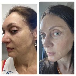 NYC Rejuvenation Clinic