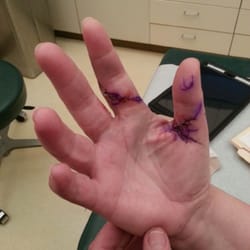 Mark E. Pruzansky, MD - Follow up appointment, bandages off, stitches stay in 2 more weeks...bummer.