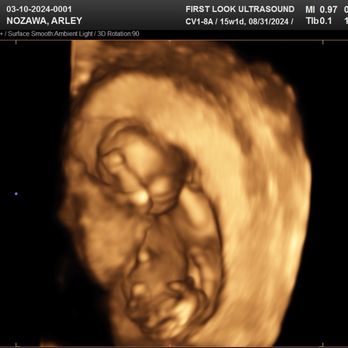 First Look Ultrasound - 15 week 3D Ultrasound - Diagnostic Imaging Near Me - Kaneohe, Hawaii