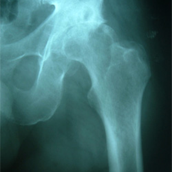 MaineOrtho - Orthopedists Near Me - Portland, Maine MaineOrtho - Orthopedists Near Me - Portland, Maine