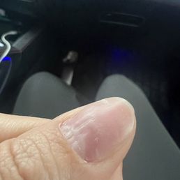 Nail bumps Nail bumps