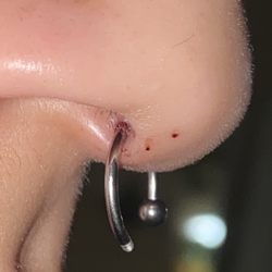 Microblading 111 - low septum, missing ball.