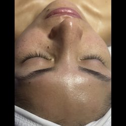 Davine Spa - How your skin looks after a facial at davine spa.
