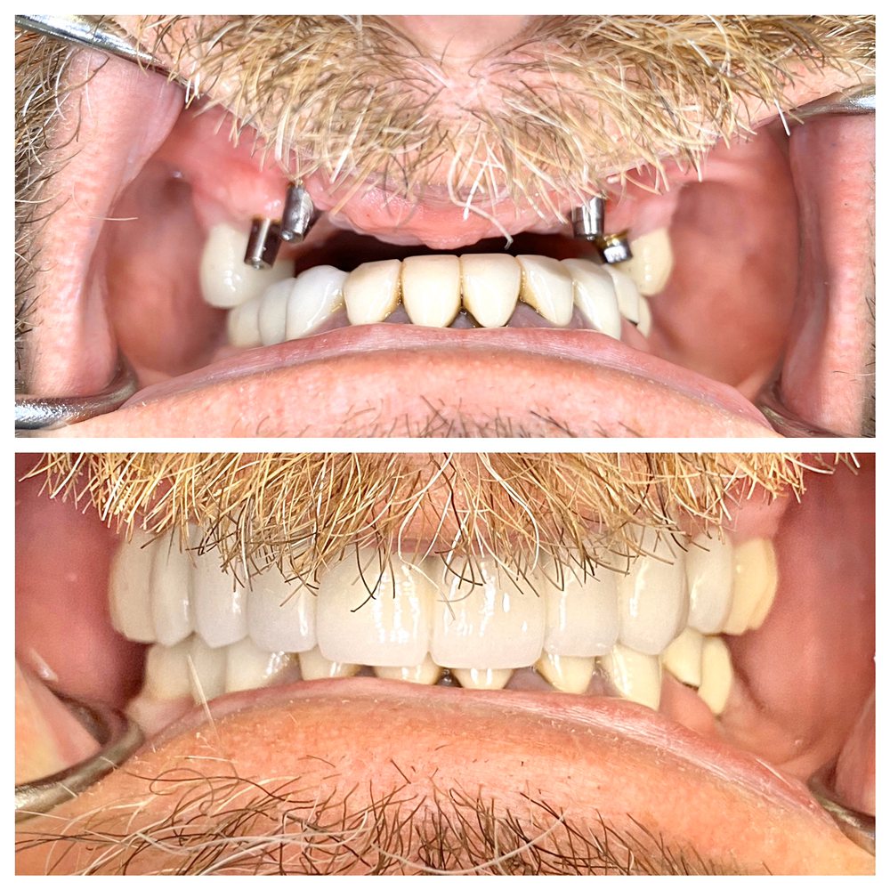 UPLAND DENTAL GROUP AND IMPLANT CENTER 106 Photos & 133 Reviews