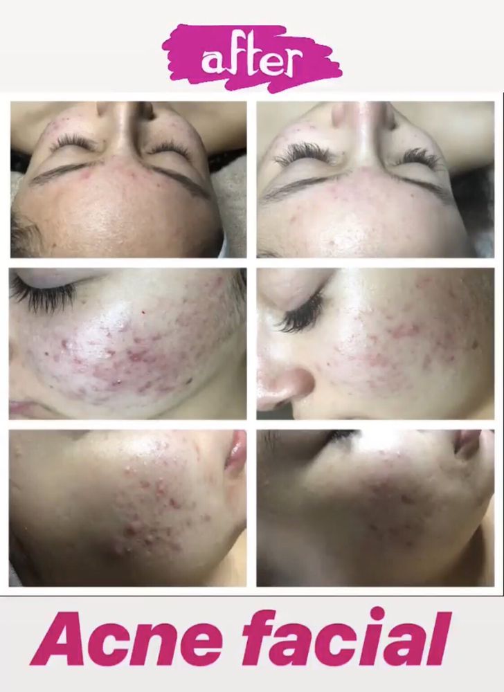 SKIN CARE AND BODY SCULPTING - 62 Photos & 45 Reviews - 8060 Florence