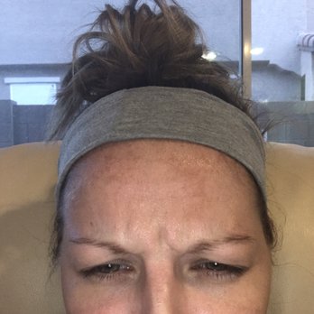 New You Medical Spa - My problem areas are still a problem. - Medical Spas Near Me - Chandler, Arizona