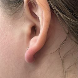 Flesh Skin Grafix Tattooing & Body Piercing - Botched piercing