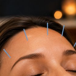 Reveal your natural radiance from within. Facial acupuncture promotes healthy circulation, supports collagen production, and enhances your s