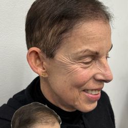 SMP By Rob - Scalp Micropigmentation gives both men and women a fuller hair look, boosting confidence with natural, lasting results.