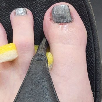 DC Nail Spa - This was the day of my service on June 1, 2026. Left foot, big toe. Was cut twice. - Nail Salons Near Me - Clarksville, Tennessee DC Nail Spa - This was the day of my service on June 1, 2026. Left foot, big toe. Was cut twice. - Nail Salons Near Me - Clarksville, Tennessee