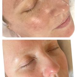 Blades & Beauty - Before and after a series of services with Lynda, about a year apart