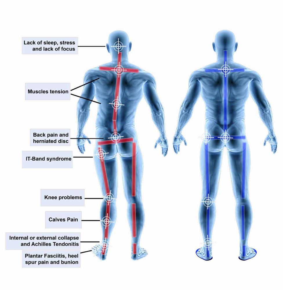 CUSTOM FEET INSOLES HOUSTON Updated October 2024 10103 Fondren Rd