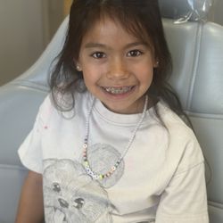 Aspen Orthodontics - Braces are almost off.