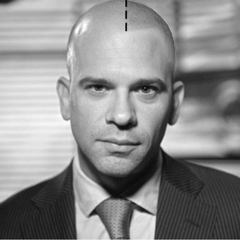 Vello Ink - Hair Loss Centers Near Me - Miami, Florida Vello Ink - Hair Loss Centers Near Me - Miami, Florida